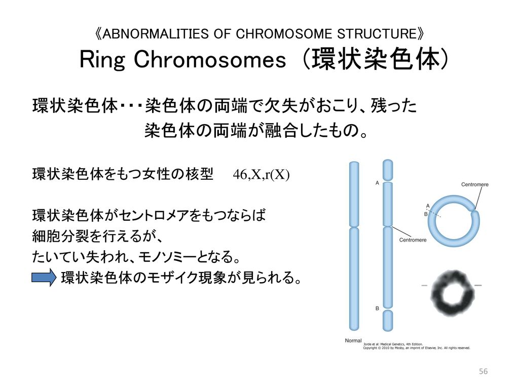 《ABNORMALITIES OF CHROMOSOME STRUCTURE》 Ring Chromosomes (環状染色体)